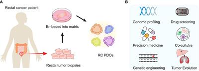 Patient-derived rectal cancer organoids—applications in basic and translational cancer research